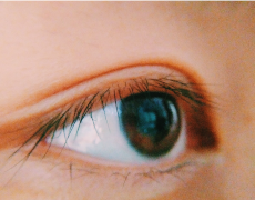 倒睫是由什么原因引起的？