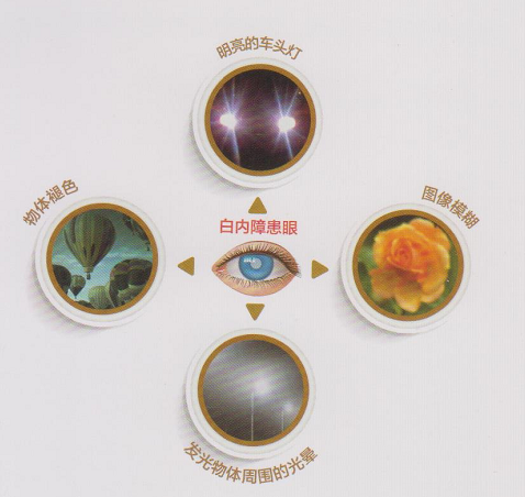 白內(nèi)障癥狀